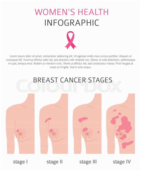 plan q brest|Treatment for breast cancer in women